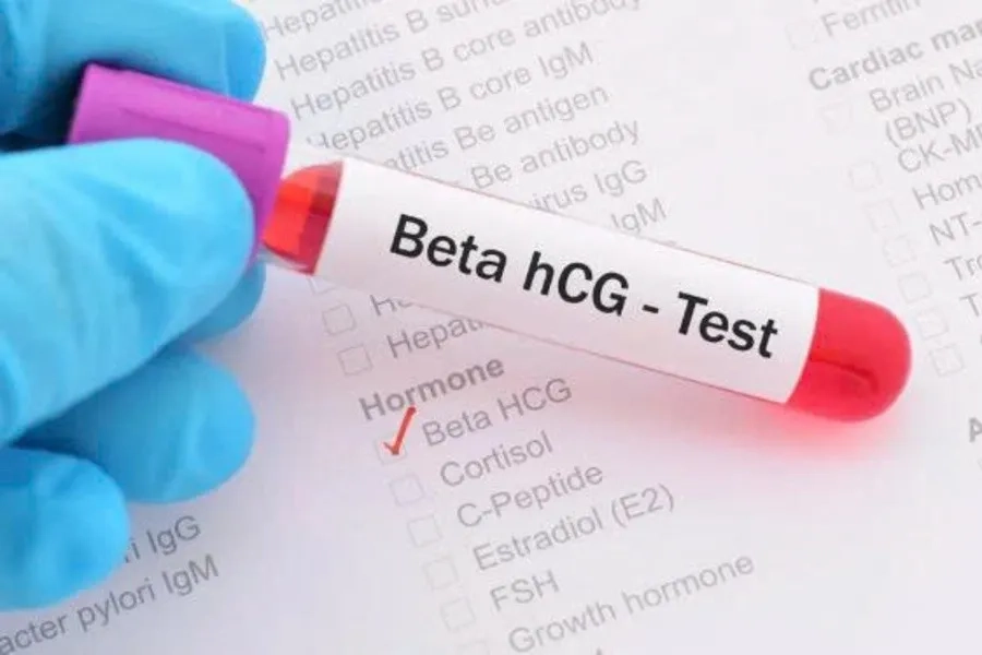 Xét nghiệm beta hCG xác định chính xác bạn đã mang thai hay chưa