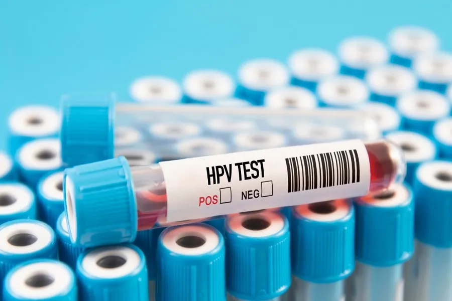Xét nghiệm HPV giúp phát hiện virus gây ung thư cổ tử cung ngay từ giai đoạn sớm