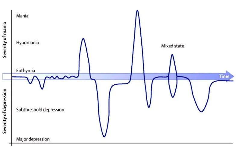 Dựa vào biểu đồ tâm trạng để đưa ra chẩn đoán chính xác về rối loạn lưỡng cực