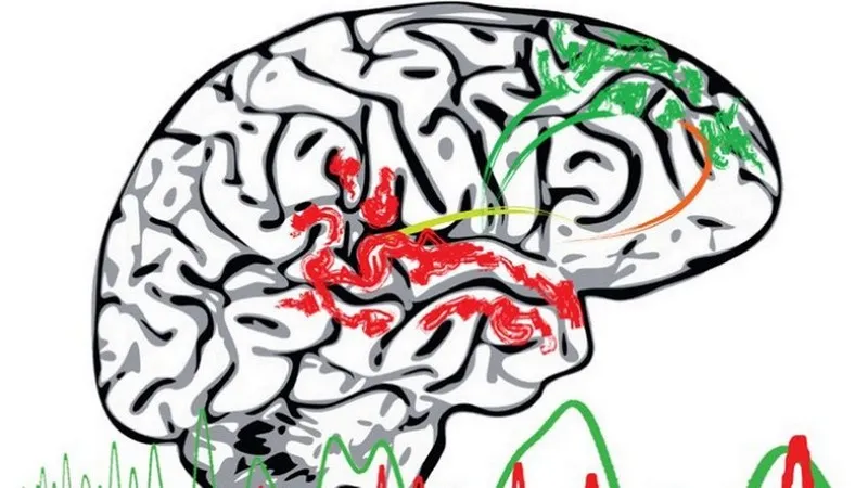 Não bộ phát triển sớm cũng có thể là nguyên nhân gây chứng tâm thần phân liệt