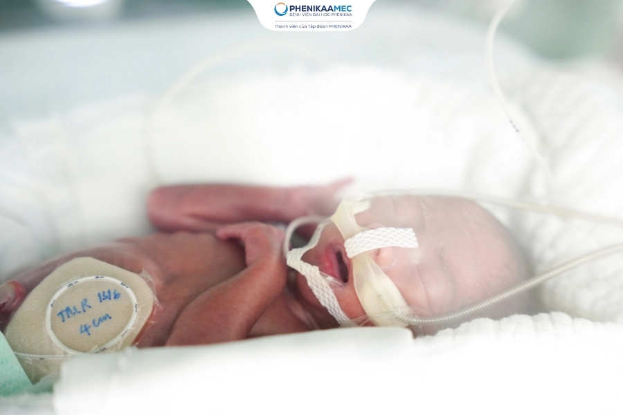 Chiến lược nuôi dưỡng trẻ sinh non hướng tới giảm thiểu biến chứng tại PhenikaaMec