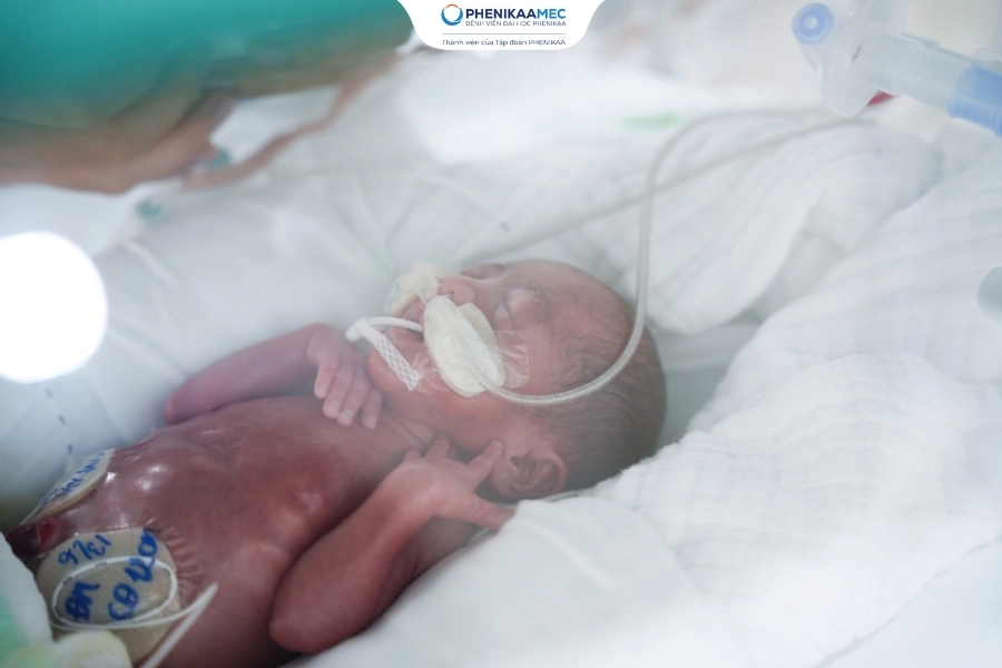 Chiến lược nuôi dưỡng trẻ sinh non hướng tới giảm thiểu biến chứng tại PhenikaaMec