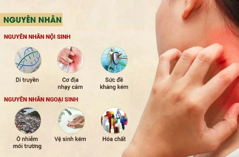 Dị ứng da có thể bắt nguồn từ nhiều nguyên nhân khác nhau