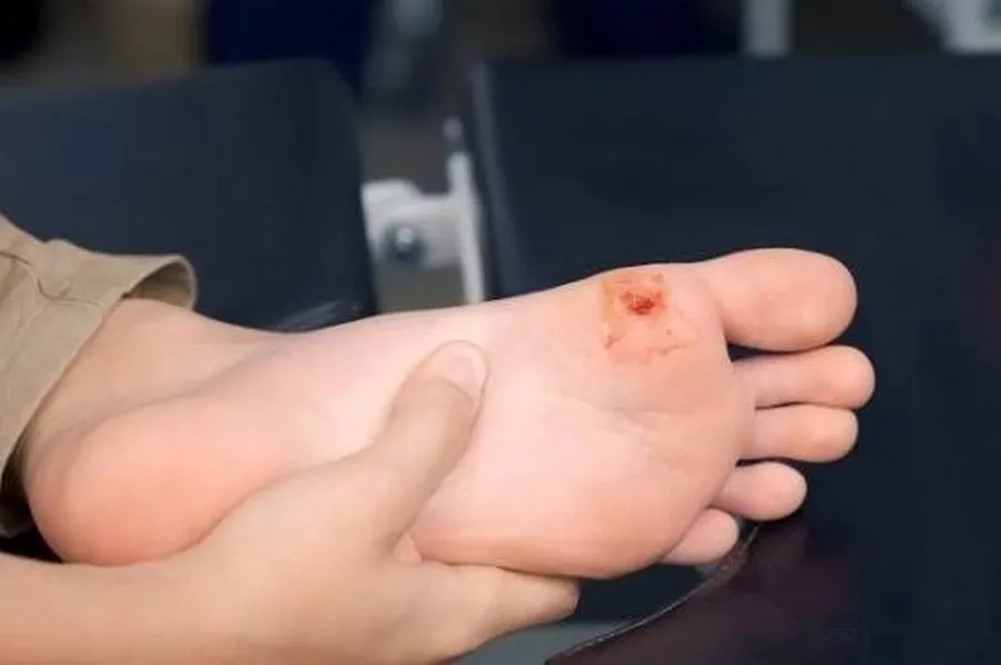 Trường hợp đinh đâm vào vết thương có thể được tiêm theo chỉ định của bác sĩ 