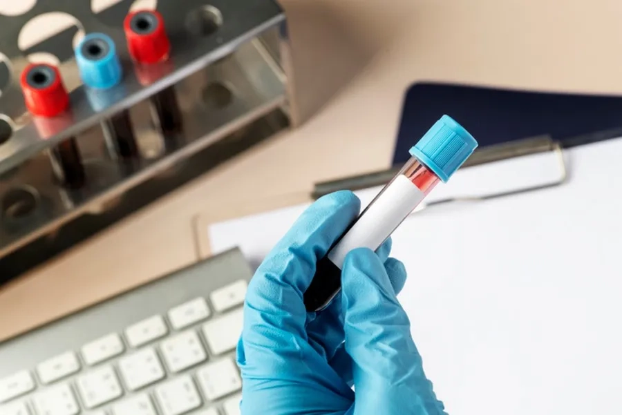 Nên thực hiện xét nghiệm Double test từ tuần thai thứ 11 đến 13 tuần 6 ngày