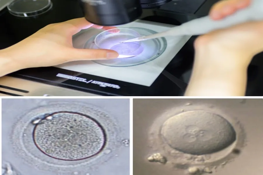 Trứng và tinh trùng sẽ được thụ tinh trong phòng Lab để tạo phôi trong khoảng 3-6  ngày