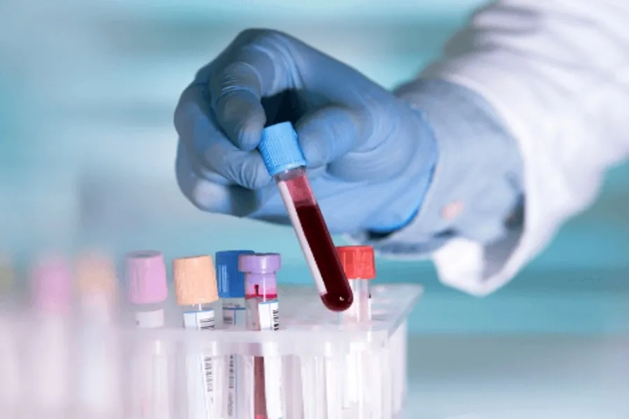 Xét nghiệm nội tiết hỗ trợ chuẩn bị cho quá trình IVF