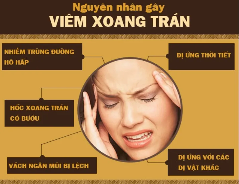 Nguyên nhân chính gây viêm xoang trán thường là do virus, vi khuẩn, dị ứng...