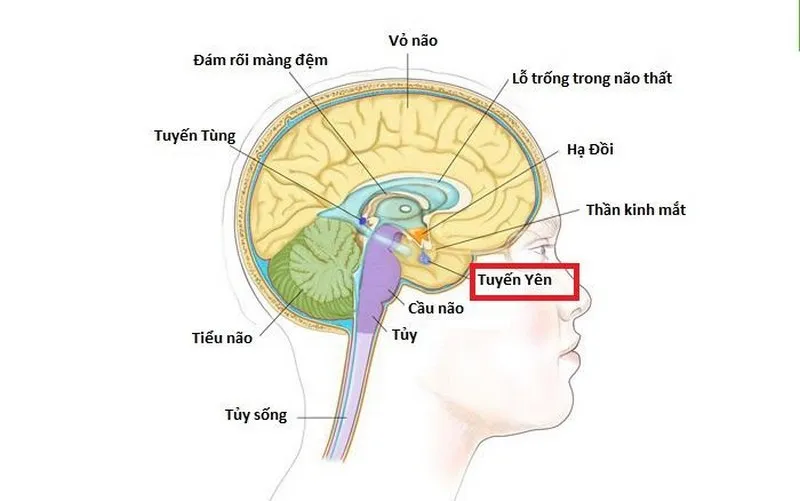 Lùn tuyến yên là bệnh lý do tuyến yên bị thiếu hụt hormone tăng trưởng