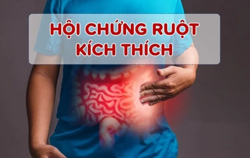 Nguyên nhân gây ra hội chứng ruột kích thích hiện chưa được xác định 