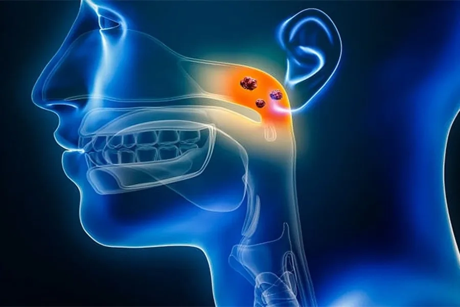 HPV 16 và HPV 18 là nguyên nhân hàng đầu gây ung thư cổ tử cung