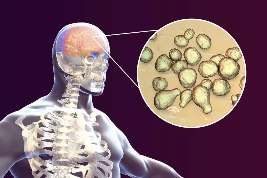 Nấm có thể từ phổi lan đến não và các cơ quan khác ở người có nguy cơ cao