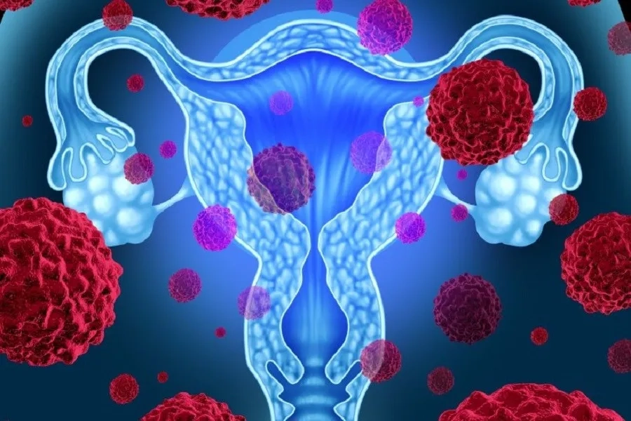 Virus HPV lây qua đường tình dục là nguyên nhân chính gây ung thư cổ tử cung