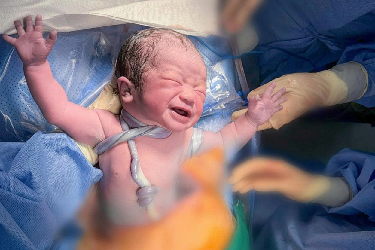 PhenikaaMec: Phát hiện sớm thai nhi dây rốn thắt nút, quấn cổ - xử trí chuẩn xác, bé chào đời khỏe mạnh