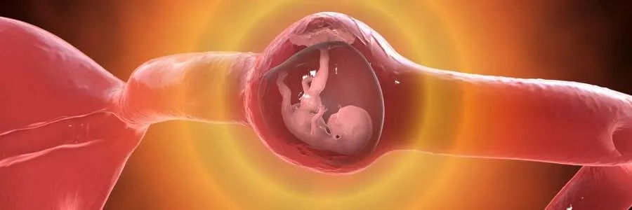 Thai ngoài tử cung thường nằm ở vị trí ống dẫn trứng