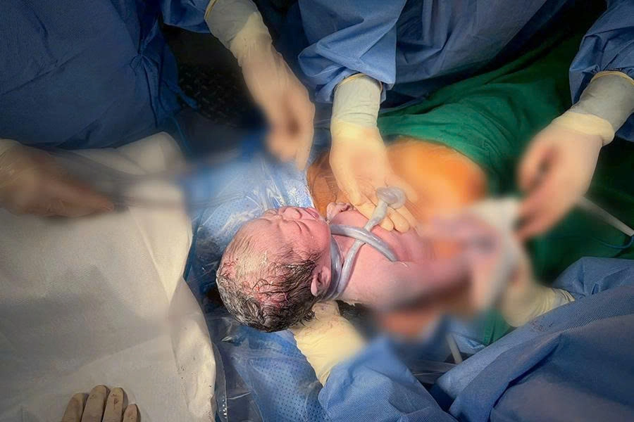 PhenikaaMec: Phát hiện sớm thai nhi dây rốn thắt nút, quấn cổ - xử trí chuẩn xác, bé chào đời khỏe mạnh