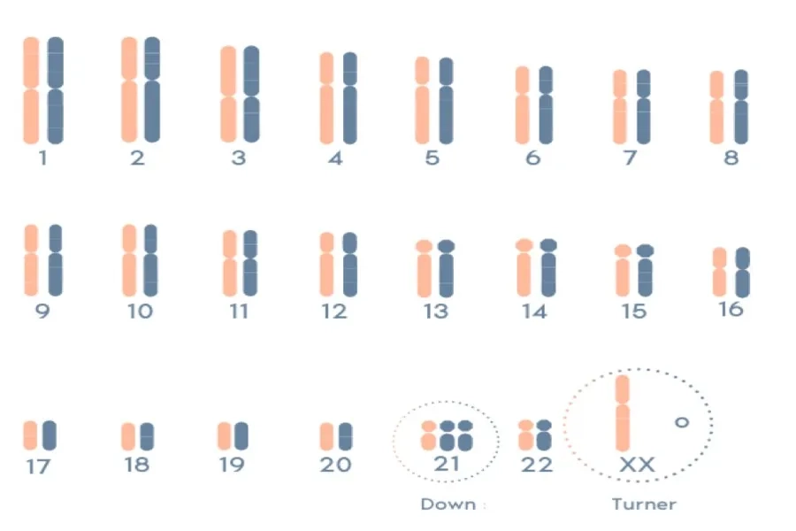 Kết quả sinh thiết phôi PGT-A cho thấy các bất thường nhiễm sắc thể