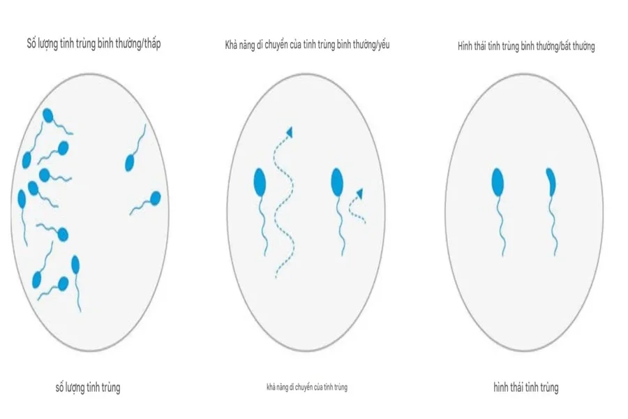 Số lượng tinh trùng ít, khả năng di động kém, hình thái bất thường,... phản ánh tinh trùng yếu