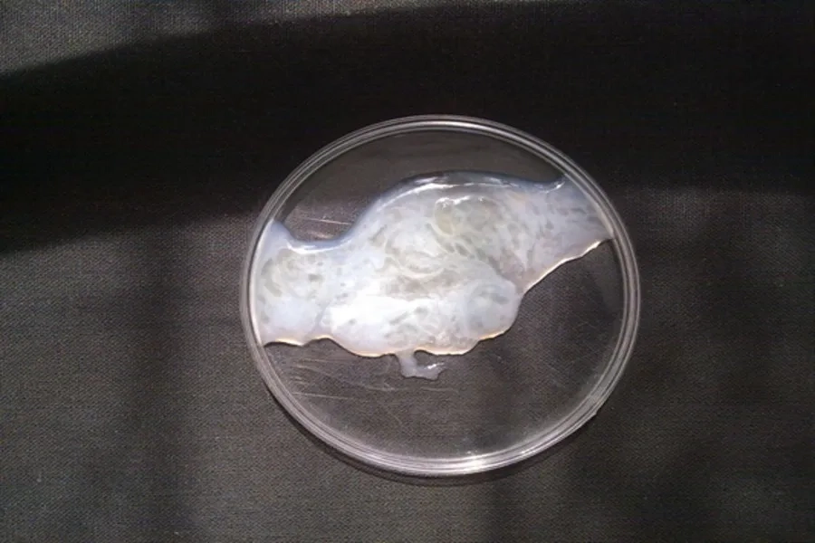 Hiện tượng tinh dịch vón cục