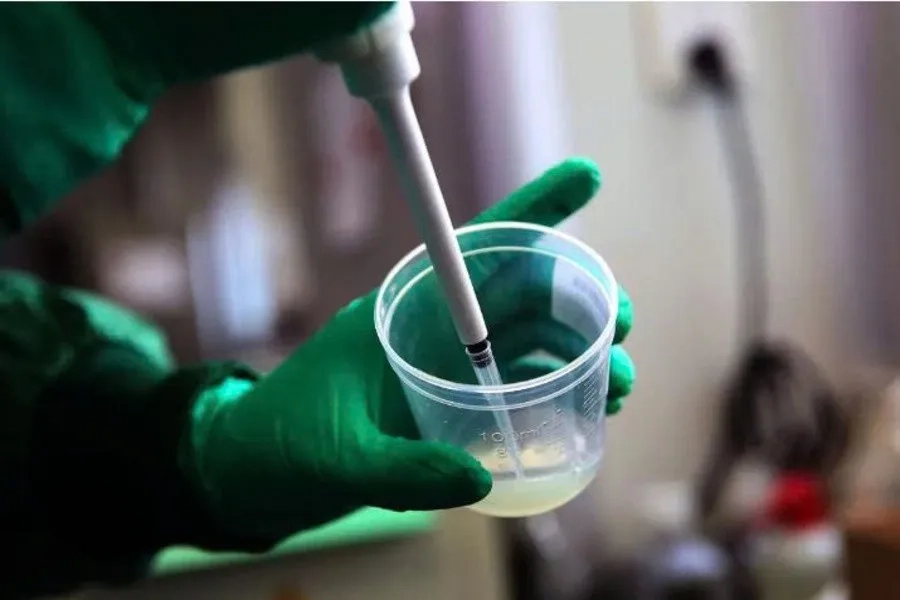 Màu sắc tinh dịch bất thường có thể ảnh hưởng đến khả năng sinh sản cần được thăm khám ngay