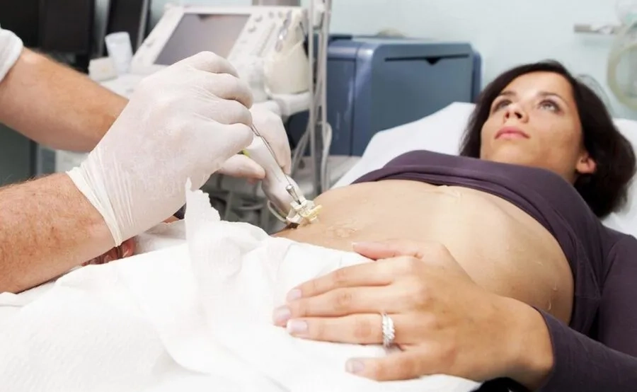 Sinh thiết gan giúp xác định hàm lượng đồng trong gan