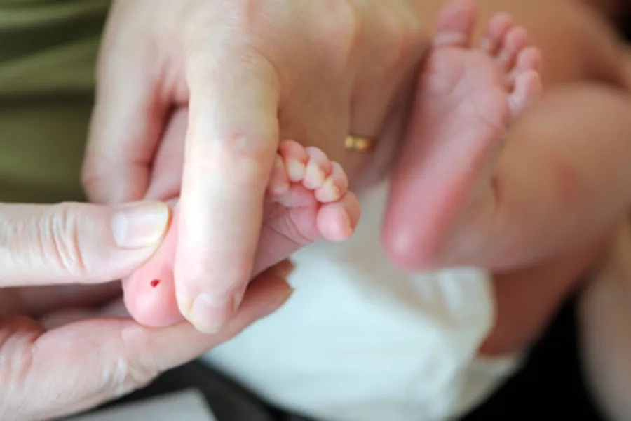 Xét nghiệm lấy máu gót chân giúp phát hiện sớm bệnh Galactosemia