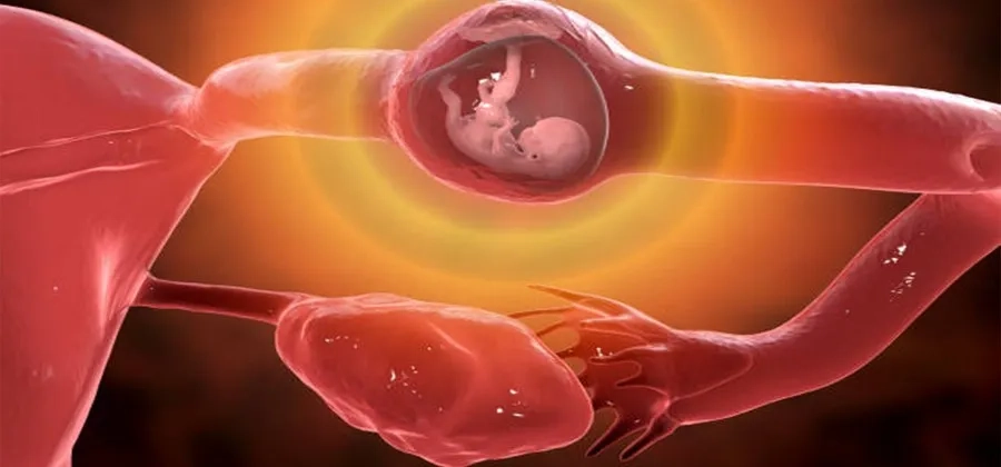 Thai ngoài tử cung có thể gây chảy máu âm đạo