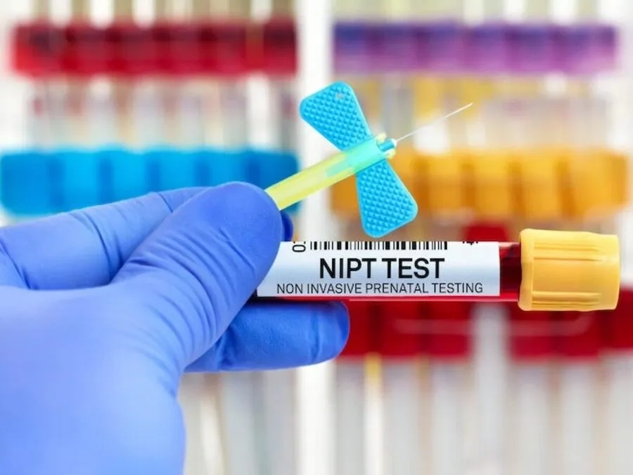 Mẹ bầu 11 tuần nên làm NIPT để phát hiện sớm các rối loạn nhiễm sắc thể