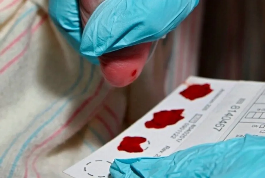 Xét nghiệm máu gót chân giúp phát hiện sớm những rối loạn chuyển hóa