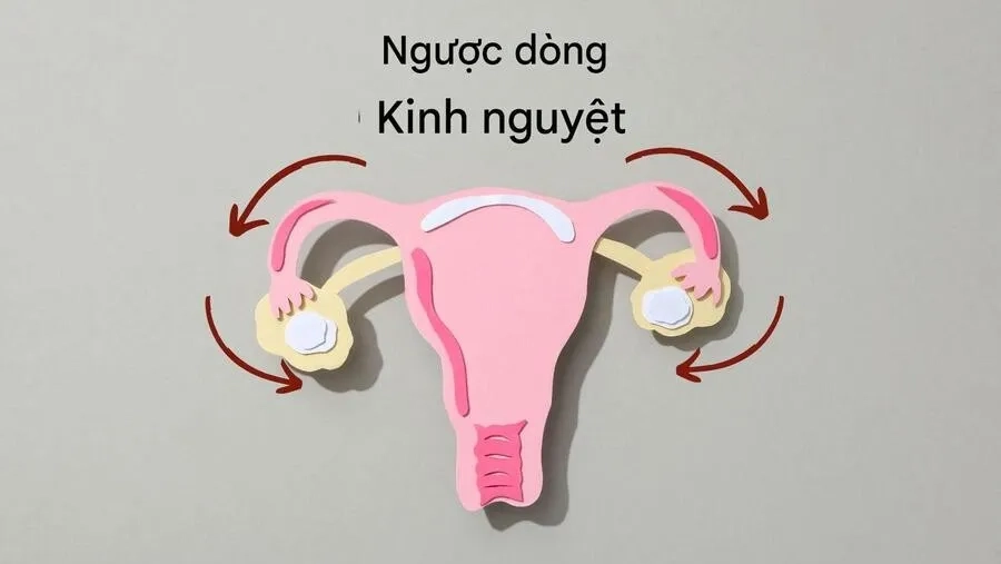 Cơ chế hình thành tổn thương liên quan đến trào ngược kinh nguyệt