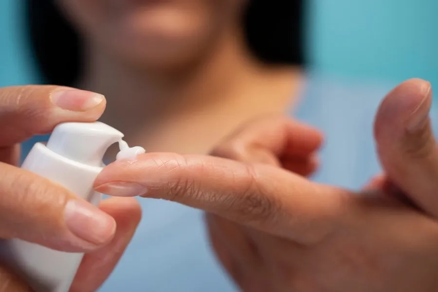 Bạn nên sử dụng thuốc bôi ngoài da chứa corticosteroid, giúp giảm viêm và làm dịu cảm giác ngứa tại chỗ