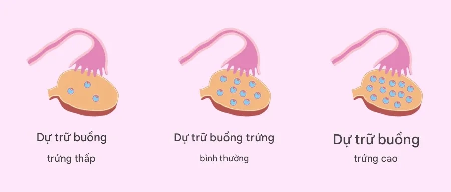 Cắt một bên buồng trứng sẽ làm giảm số lượng nang noãn dự trữ