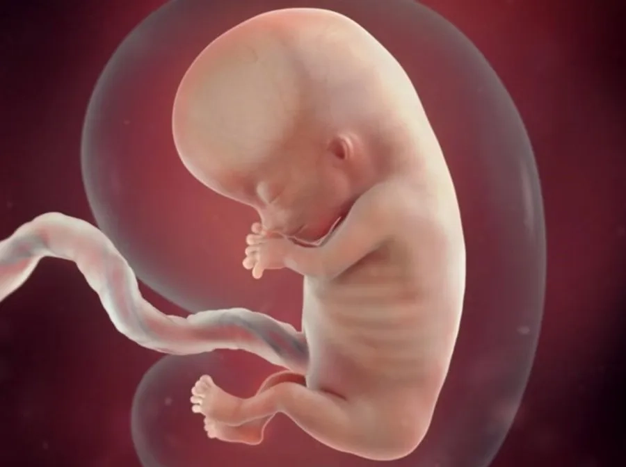 Túi ối nhỏ hơn tuổi thai có thể là dấu hiệu tiềm ẩn nguy cơ ảnh hưởng đến sự phát triển của bé