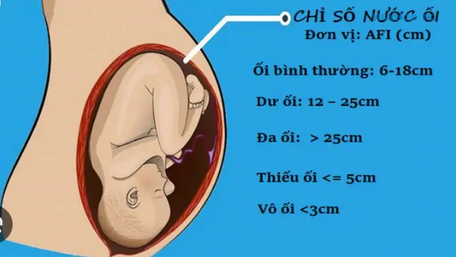 Mẹ bầu nên theo dõi chỉ số nước ối định kỳ để phát hiện sớm các bất thường, đảm bảo an toàn cho thai kỳ