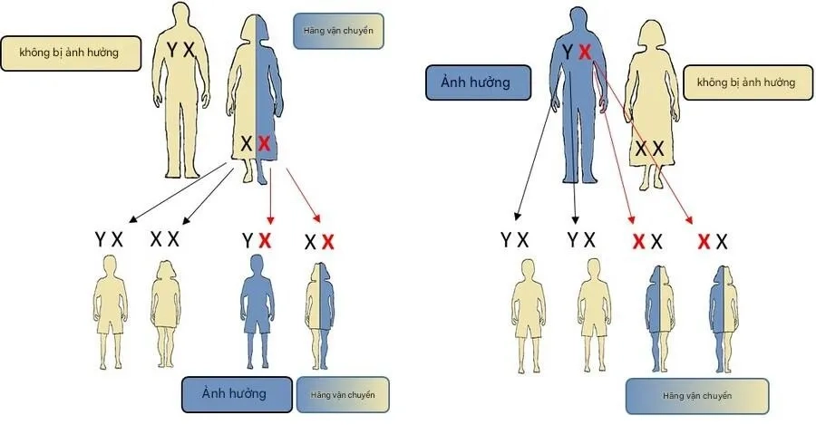 Loạn dưỡng chất trắng thượng thận liên kết X là một rối loạn di truyền hiếm gặp