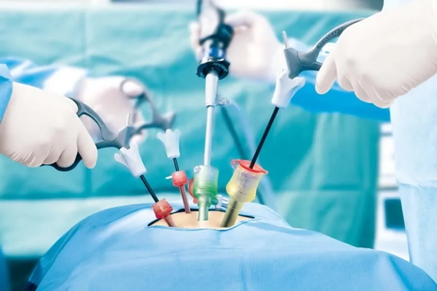 Phẫu thuật nội soi là phương pháp thường được áp dụng khi cần can thiệp
