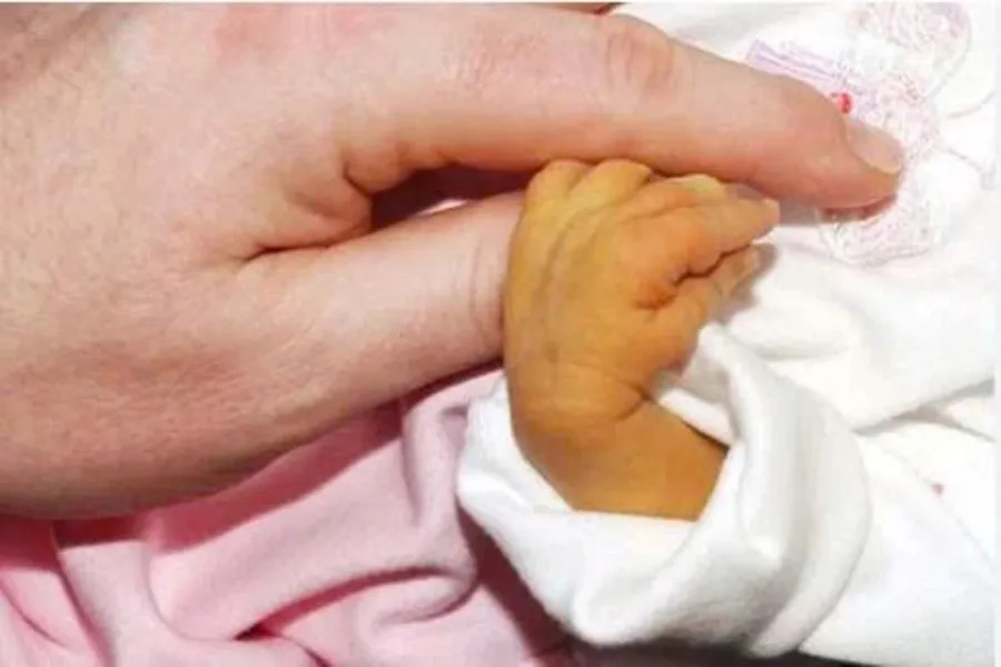 Em bé sinh non, vàng da nặng cần được bác sĩ chuyên khoa tư vấn trước khi tiêm 