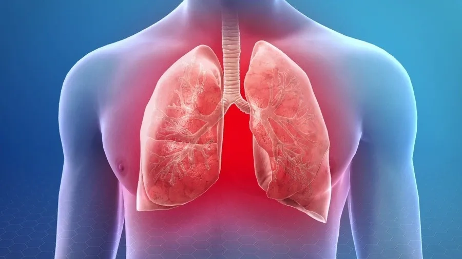Viêm phổi và viêm phế quản có thể gây khó thở và suy hô hấp
