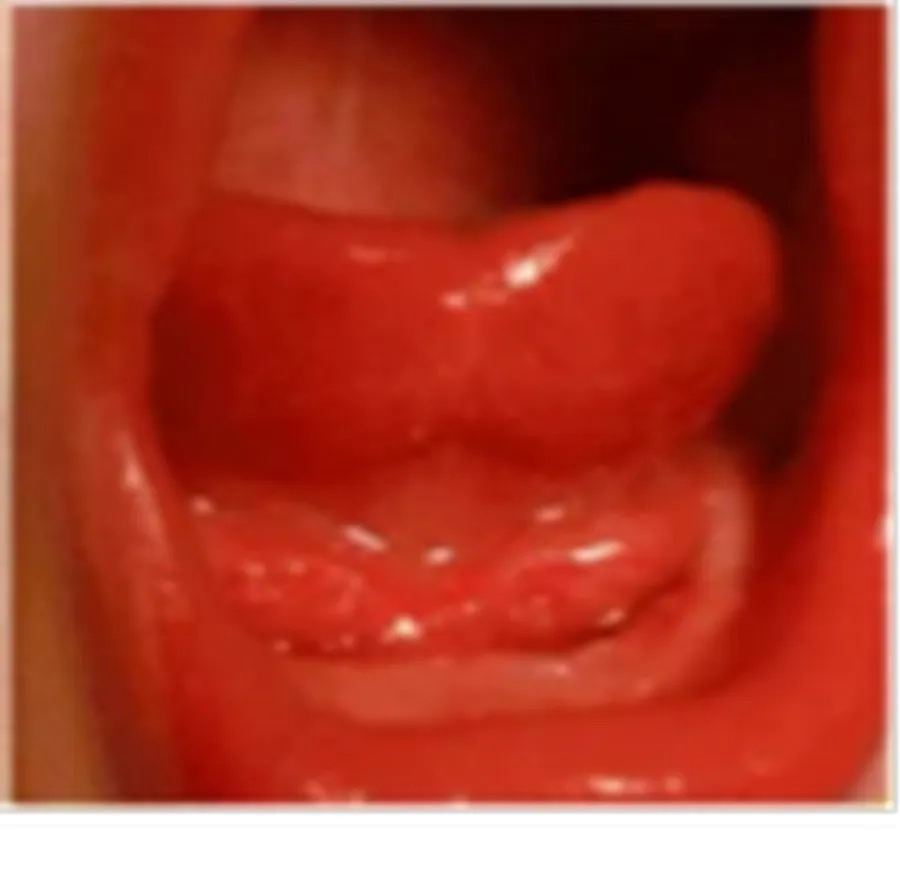 Mức độ 1