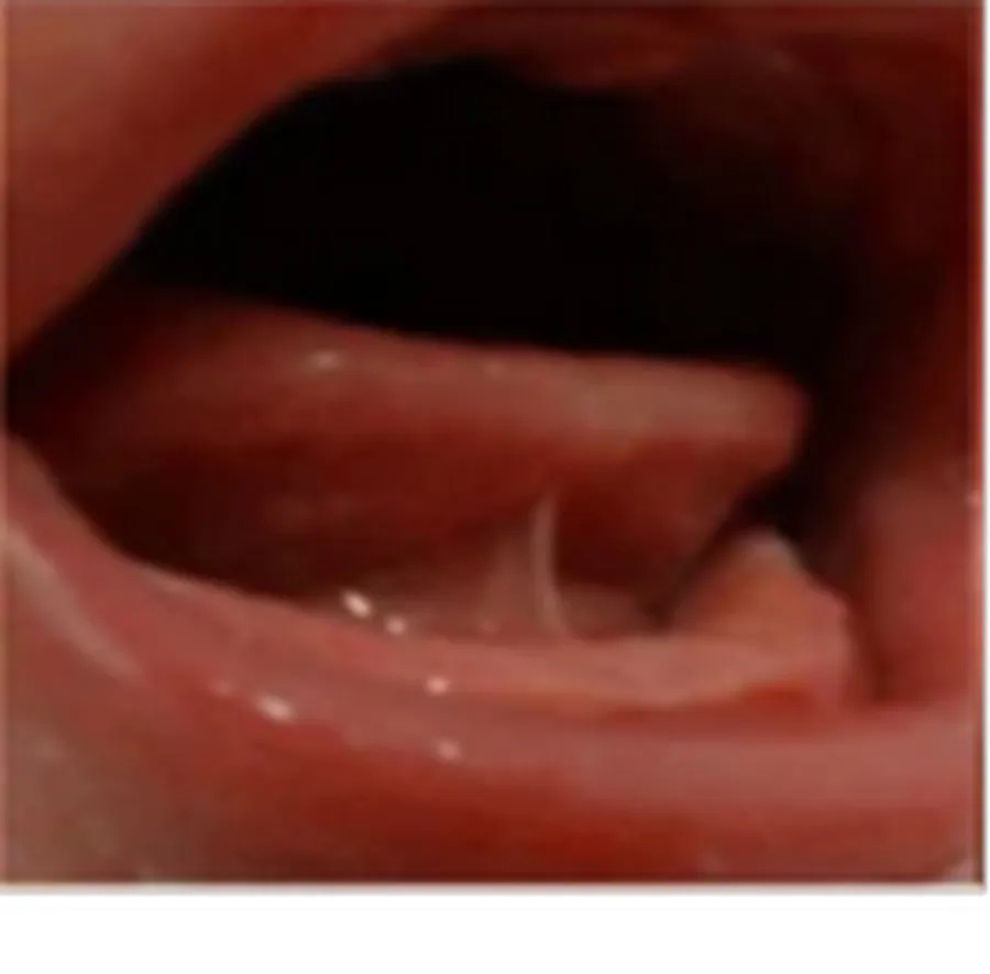 Mức độ 3