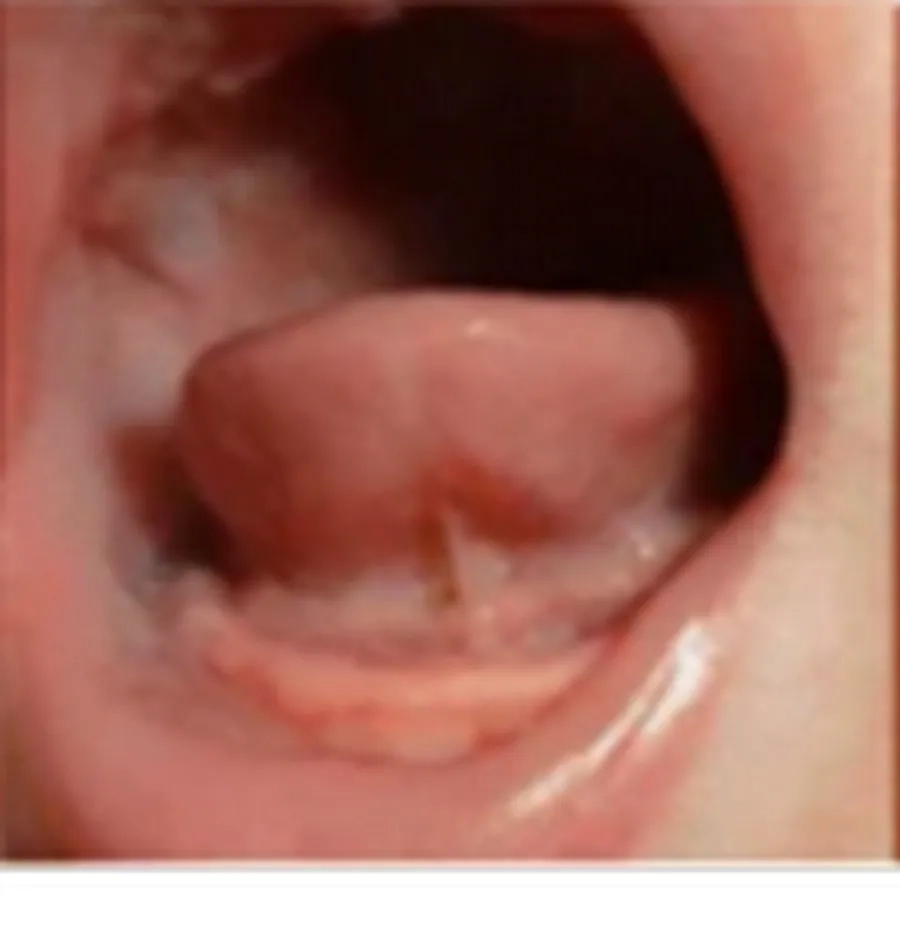 Mức độ 2