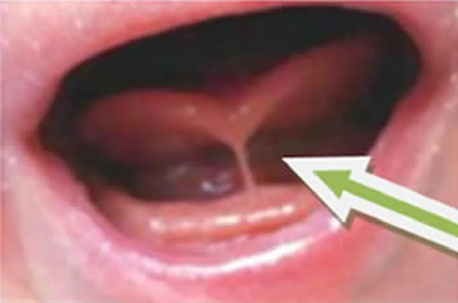 Mức độ 4