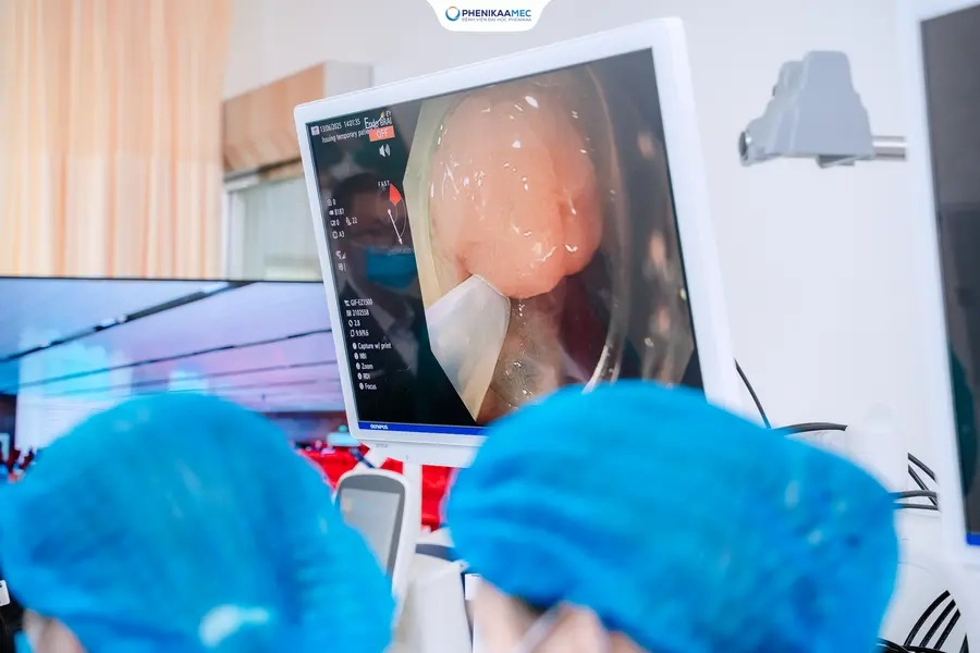 Hội Thảo Thực Hành Đào Tạo Nội Soi Đại Trực Tràng Mô Phỏng Và Chiến Lược Điều Trị Ung Thư Đại Trực Tràng Sớm Qua Nội Soi