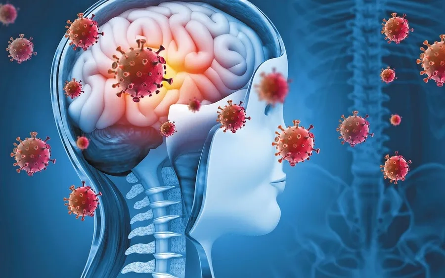Virus sởi có thể ảnh hưởng đến não và hệ thần kinh trung ương