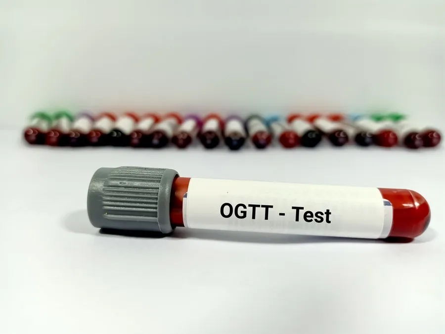 Tầm soát đái tháo đường thai kỳ bằng nghiệm pháp dung nạp glucose