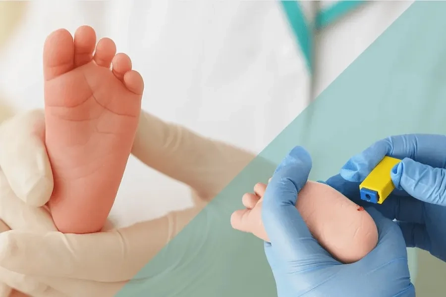 Quy trình lấy máu gót chân diễn ra nhanh chóng, an toàn và ít gây khó chịu cho bé