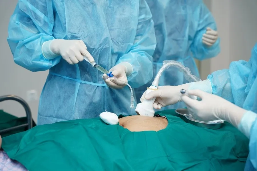Chọc ối thường thực hiện từ tuần thai 16 để đảm bảo an toàn và hiệu quả