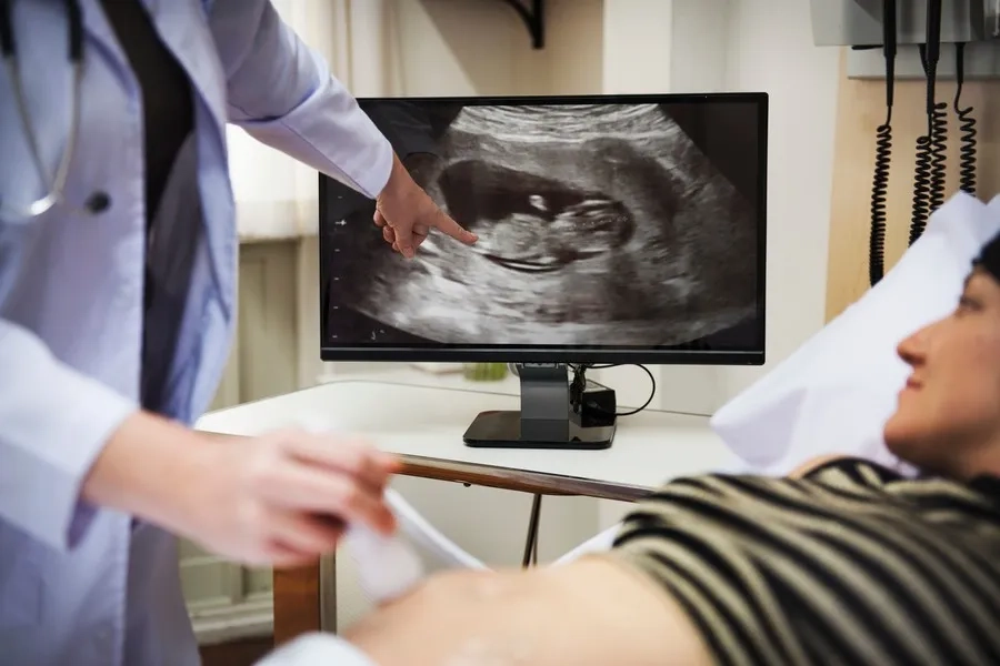 Mẹ bầu nên thực hiện siêu âm định kỳ để được bác sĩ theo dõi và phát hiện sớm bất thường 