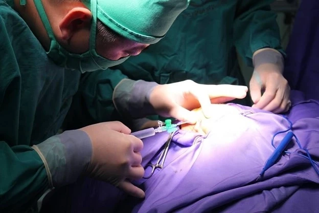 Phương pháp điều trị thoát vị hoành thai nhi