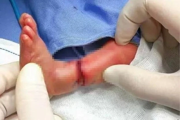 dải sợi ối có nguy hiểm không
